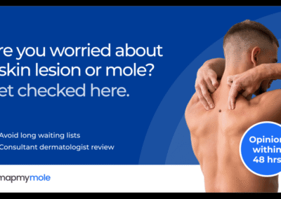 Map My Mole – Skin Check
